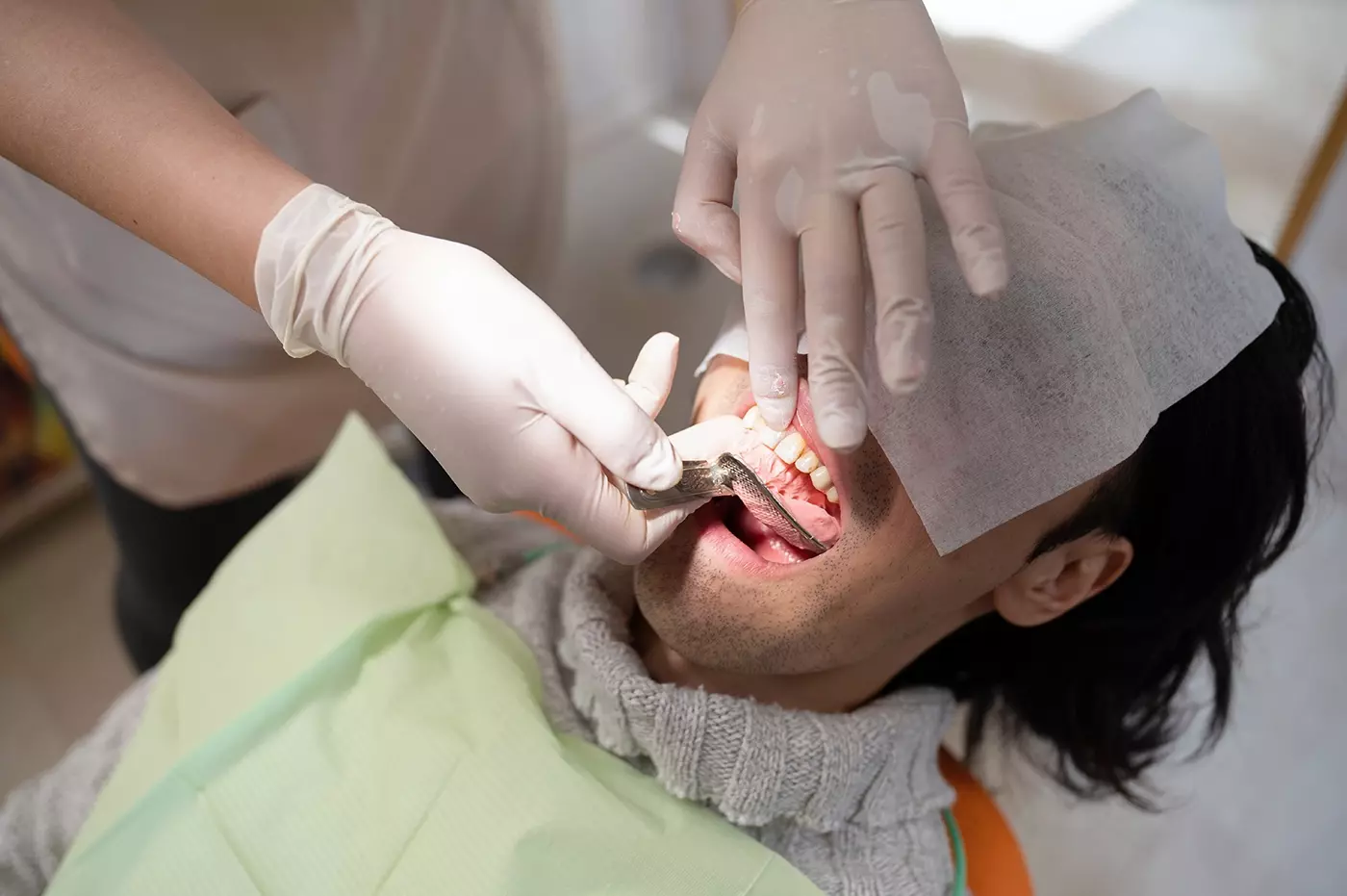 歯周病治療のプランについて