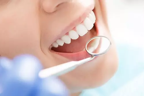 当院の予防歯科治療